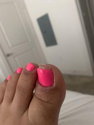 Toes nails