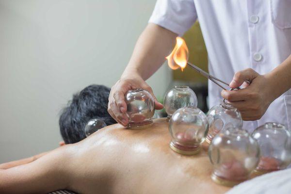 Fire Cupping