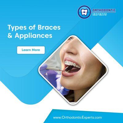 Traditional braces and Invisalign are the two most common orthodontic appliances. To know more about other appliances visit our website.