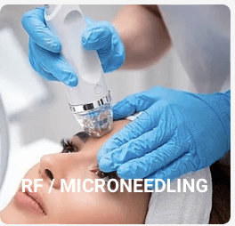 The morpheous8 radio frequency RF/Microneedling offers a re-texturizing of the skin to smooth wrinkles and diminish acne scars