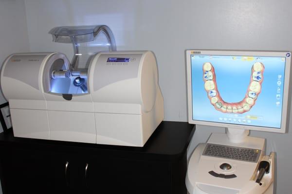 Don't Have Time For Two Dental Appointments? CEREC One-Visit Crowns Offer Convenience for Jackson Dental Patients