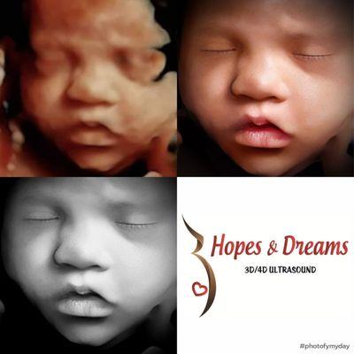 Hopes & Dreams 3D/4D Ultrasound