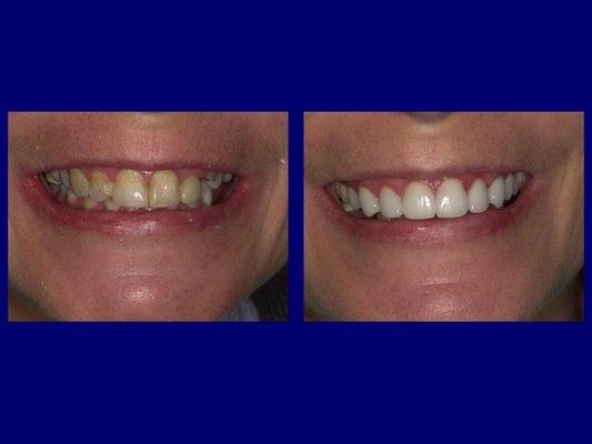 We offer the latest advancements in Cosmetic Dentistry!