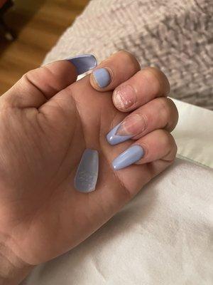 Broken nails