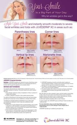 Get 10 % off of your first Juvederm treatment!