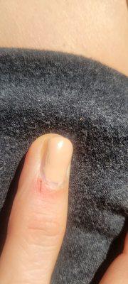 Cut cuticle