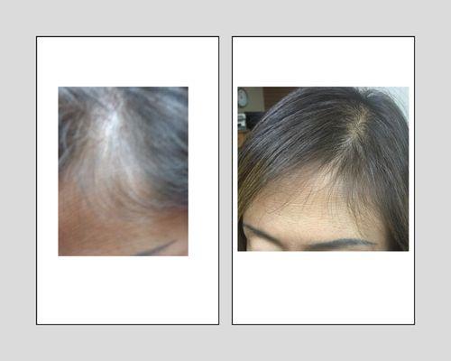 We work as a team to aid clients in the revitalization of their hair.