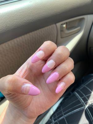 Terrible nails