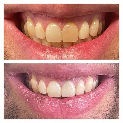 Niki Zarabian DDS-Sherman Oaks Smile Studio