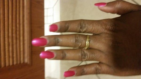 Later that day nails began to break on the opposite (left) hand!