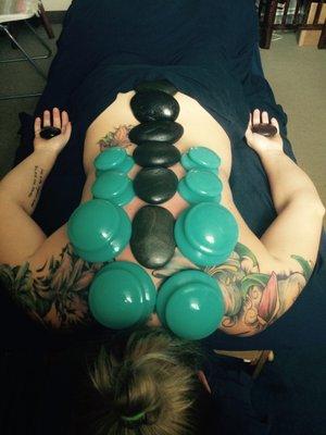 Cupping therapy with hot stones.