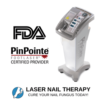 Laser nail therapy. Toenail fungus. Cure your toenail infection with laser machine.