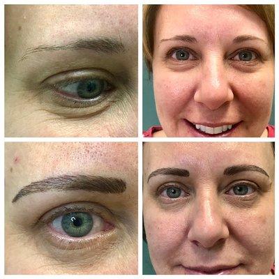 Lift brows by improving the arch and volume of the brow. This will lighten about 40%