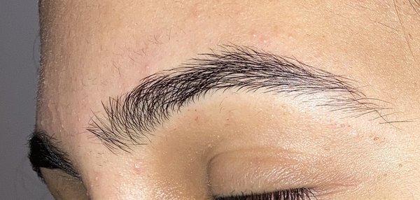 Cuts on brow area