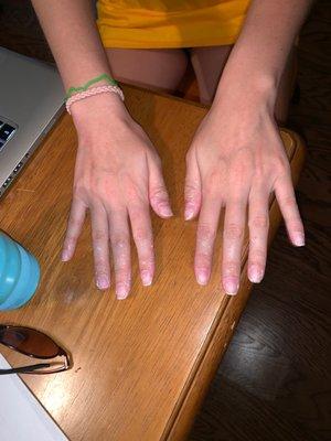 Acetone Soaked Fingers