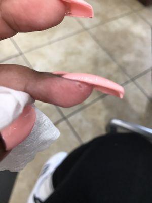 My finger cut