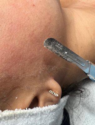 Dermaplaning Facial