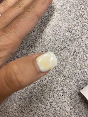 White gel nails and 4 days after I got them done yellowish spots started showing up