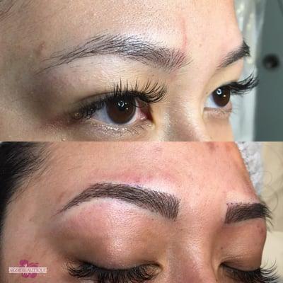 Before and after left brow