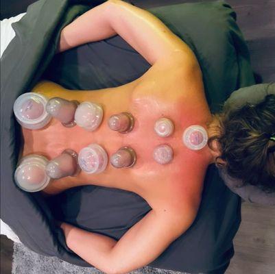 cupping service.