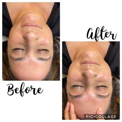 Brow Shaping