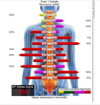 Myovision scan