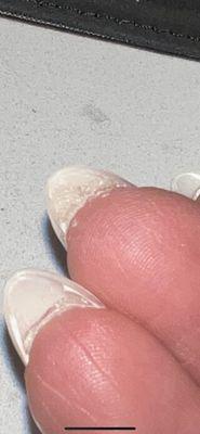 bonding gel under nail