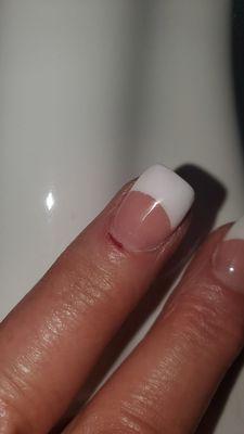 My bleeding cuticle because he was rushing!