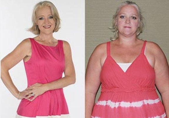 Ladonna lost 138 pounds with gastric sleeve surgery.