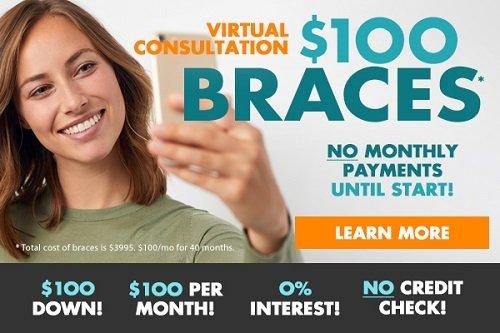 Adults Kids Braces $100 Down-$100/month-0% APR CALL NOW