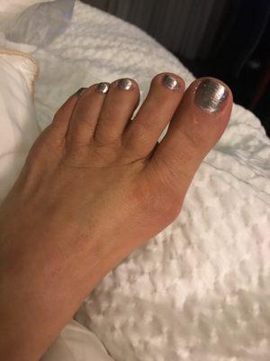 Silver sparkle