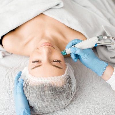 Microdermabrasion