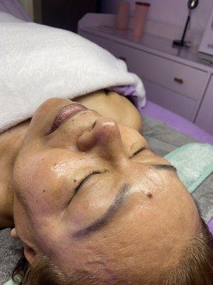 Anti-aging facial