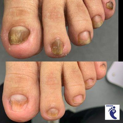 Clinical Pedicures