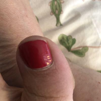 Ridges left in nail