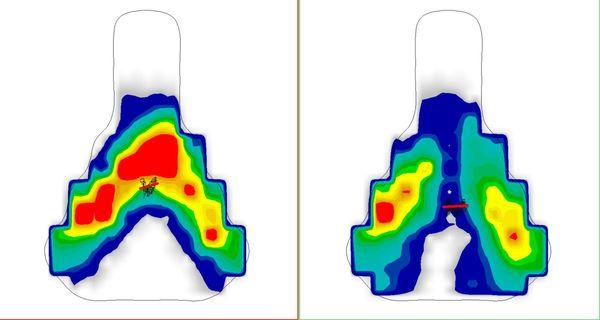 Digital Pressure Mapping