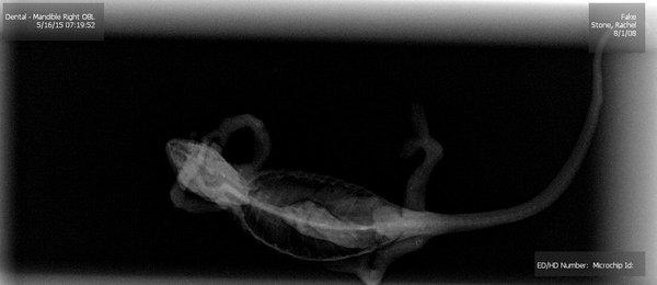 Xray before treatment for metabolic bone disease.