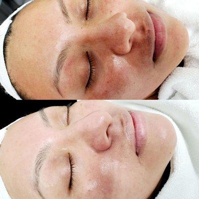 GLOWZONE  Book ur appointment for a relaxing Facial while getting healthier, younger looking skin.