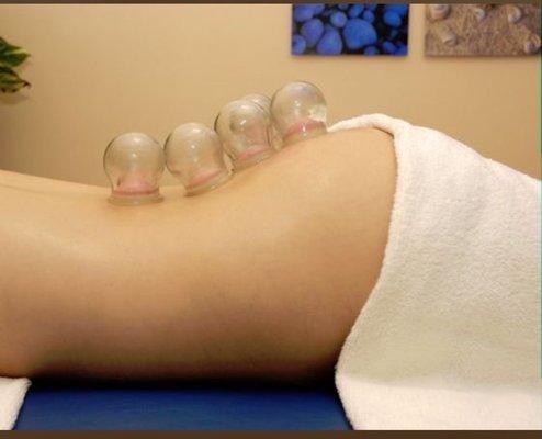 Cupping