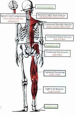 Body Imbalance resulting from an Atlas Subluxation!