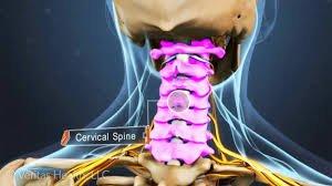 Cervical Therapy