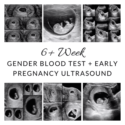 6 Week Gender Testing + Ultrasound