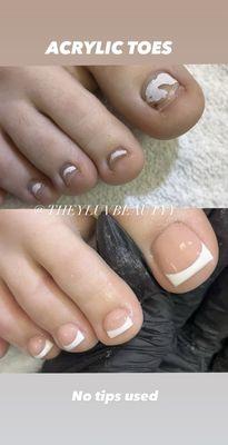 Acrylic toes