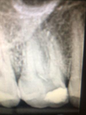 xray from different dentist