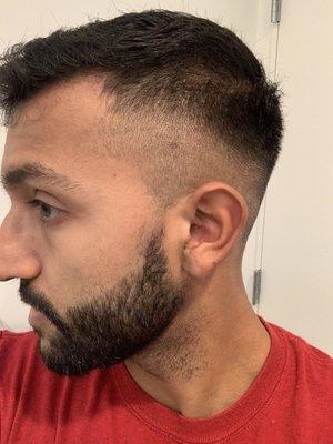 Side view after cut