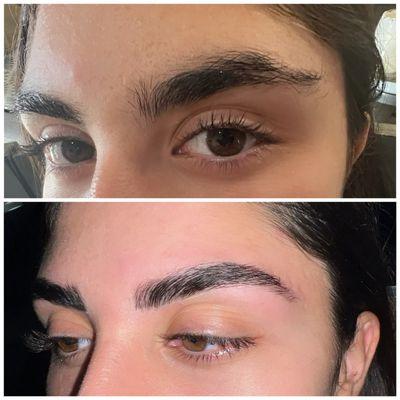 Brow limitation