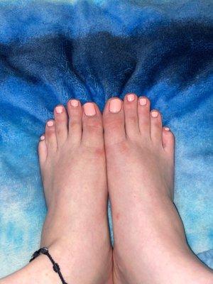 My messed up "pedicure"