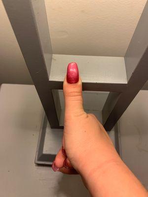 Uneven thumb