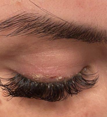 Allergic reaction lash artist Nathania was aware of but didn't know how to advise on treatment or solution