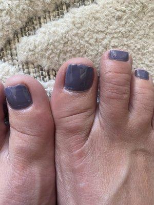 Post pedicure